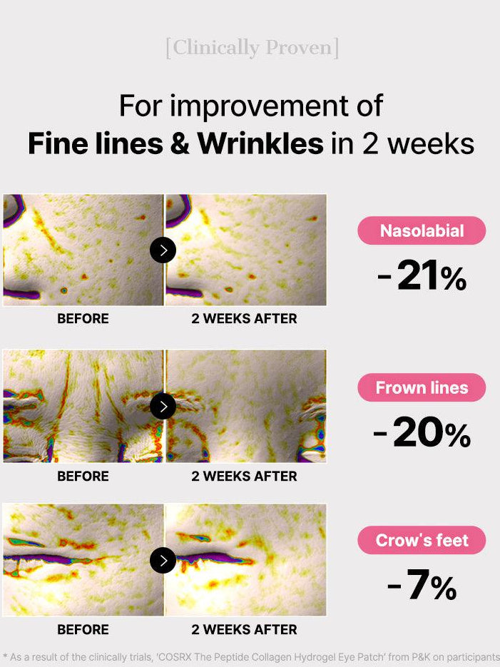 Noctéra Peptide Collagen Hydrogel Eye Patch ™