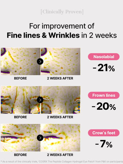 Noctéra Peptide Collagen Hydrogel Eye Patch ™