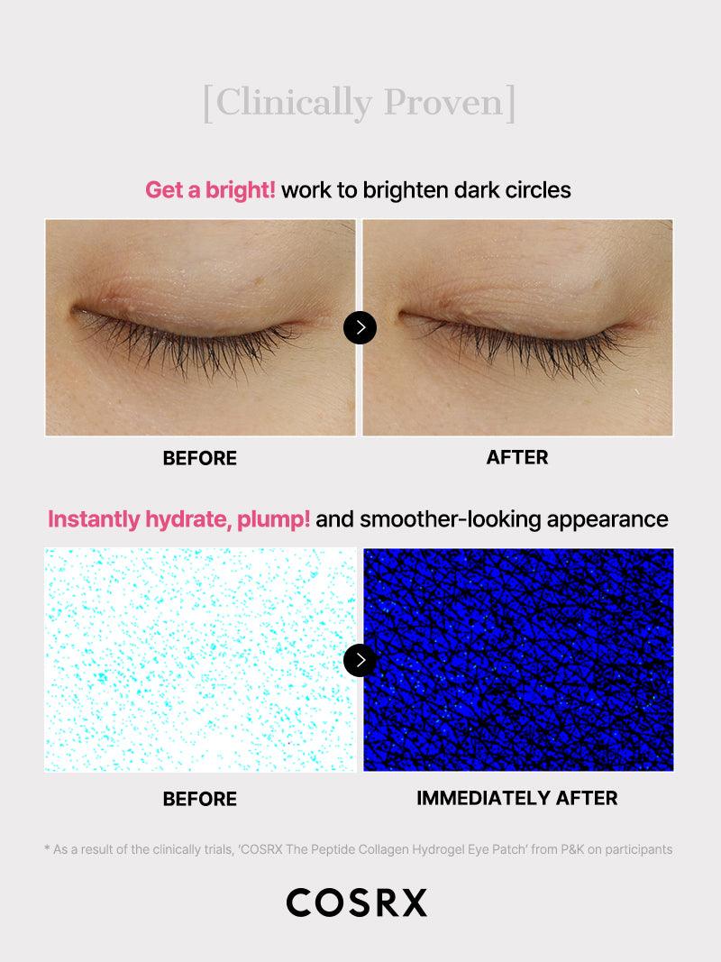 Noctéra Peptide Collagen Hydrogel Eye Patch ™